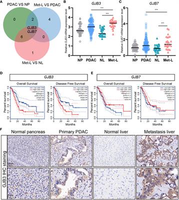 GJB3 promotes pancreatic cancer liver metastasis by enhancing the polarization and survival of neutrophil